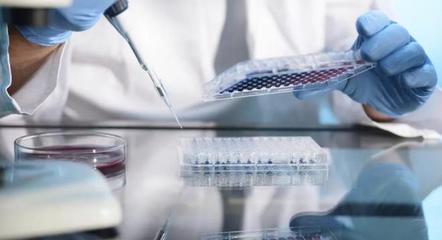 國內(nèi)細(xì)胞治療產(chǎn)品審批提速 載體制造如何擺脫"被動追趕"局面?